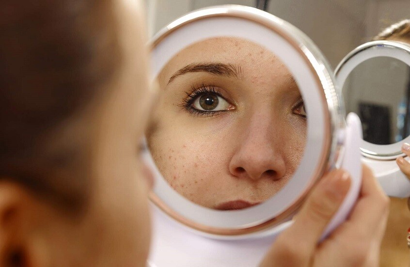اختصاصية جلدية تحذر: اصفرار الجلد قد يشير إلى أمراض خطيرة متعددة