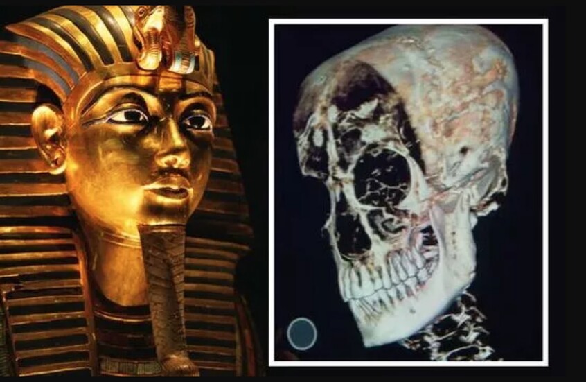 زاهي حواس يكشف الحقيقة الكاملة وراء وفاة توت عنخ آمون