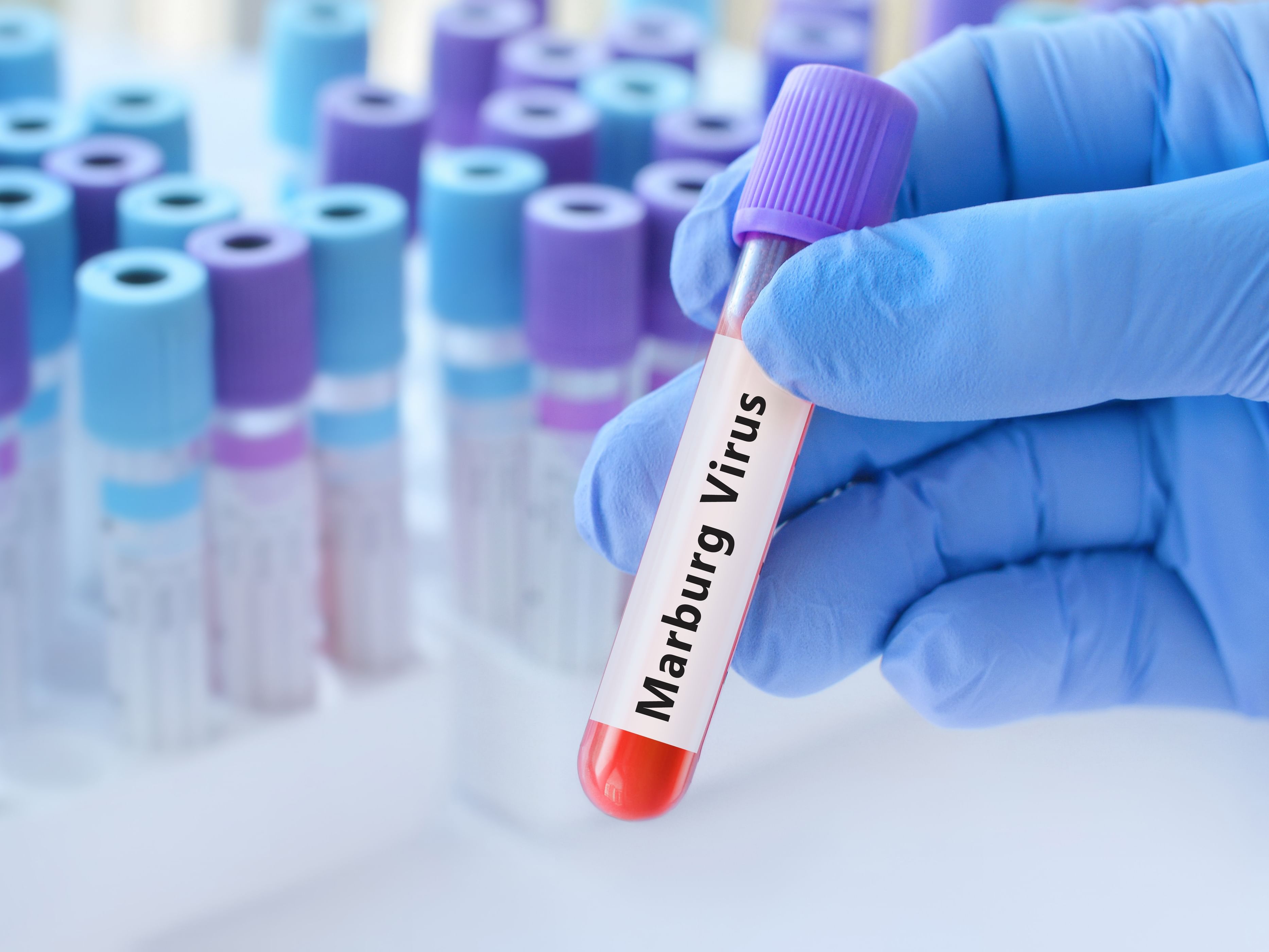 إثيوبيا تعلن تفشي فيروس "ماربورغ" للمرة الأولى وتسجل 9 إصابات في إقليم أومو