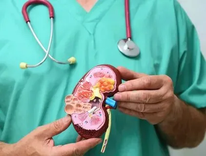 أبرز علامات سرطان الكلى.. تعرف عليهم