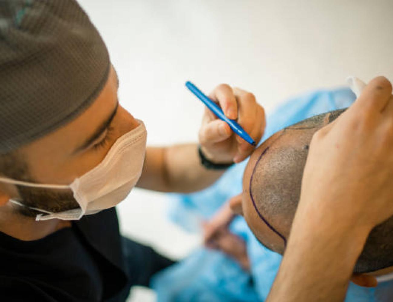 صناعة زراعة الشعر تحقق نمواً قياسياً بـ11 مليار دولار سنوياً