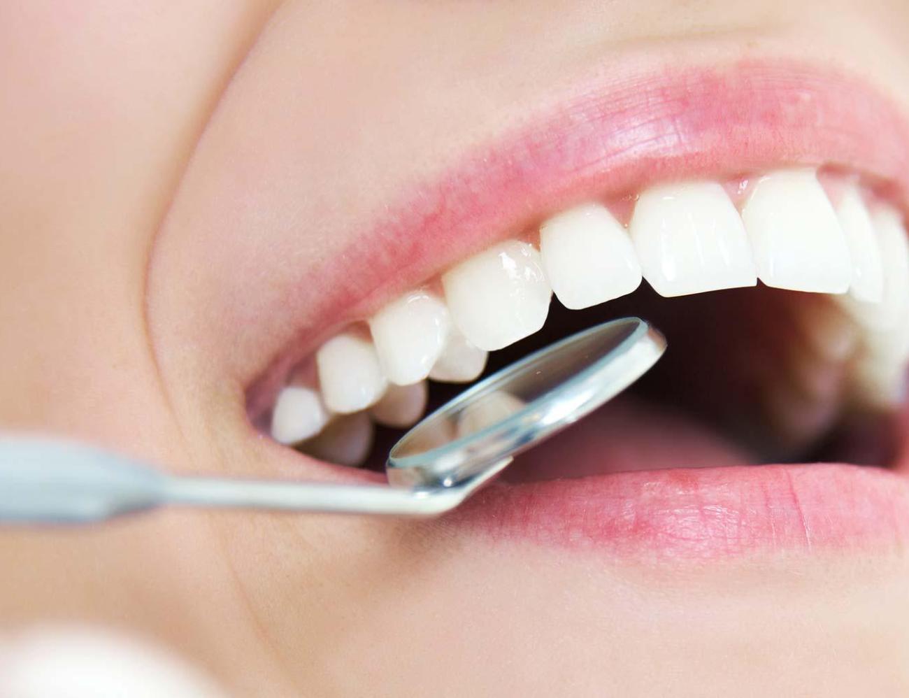 دراسة: السكر يُطلق تفاعلات فورية تُضعِف مينا الأسنان خلال دقائق