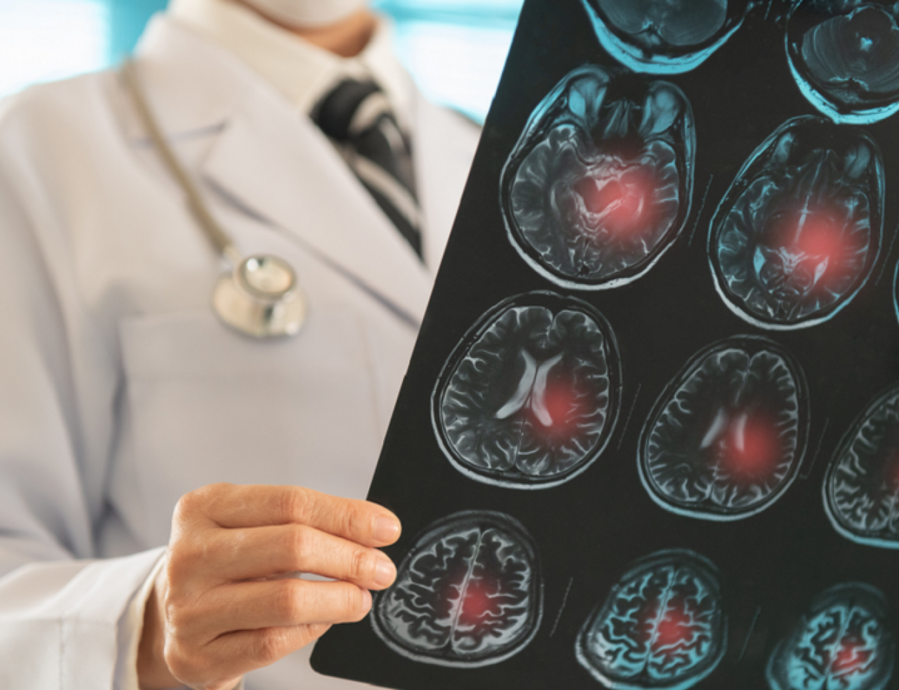 باحثو كامبريدج يبتكرون جهاز "Revoice" لإعادة النطق لمرضى السكتة الدماغية دون جراحة